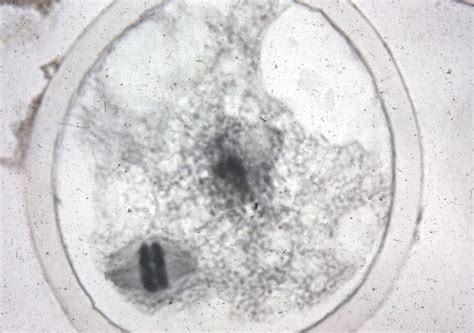  Dientamoeba fragilis – Olosuhteista riippuen sekä loisena että vaarattomuutena esiintyvä yksi soluinen organisme