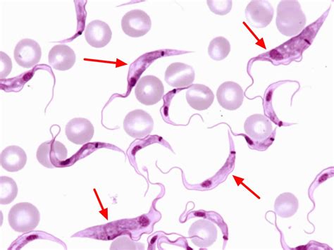  Trypanosoma brucei: Miksi tämä mikroskooppinen mato aiheuttaa afrikkalaista unta ja miten se selviytyy elimistössä?